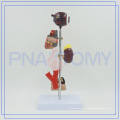 PNT-0758 diabetes set model for hospital